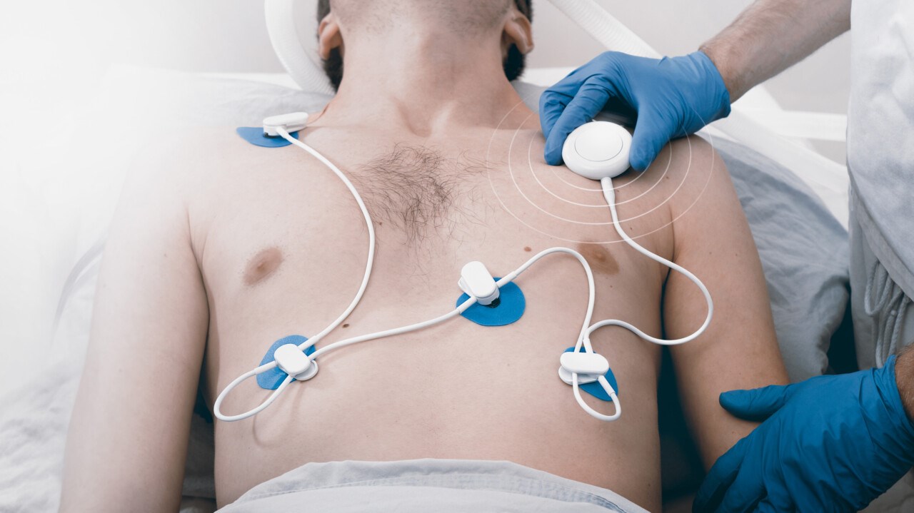 Bild på patient med EKG-utrustning på bröstet