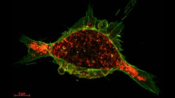 cancercell