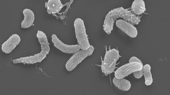 mikroskopbild på marina bakterier