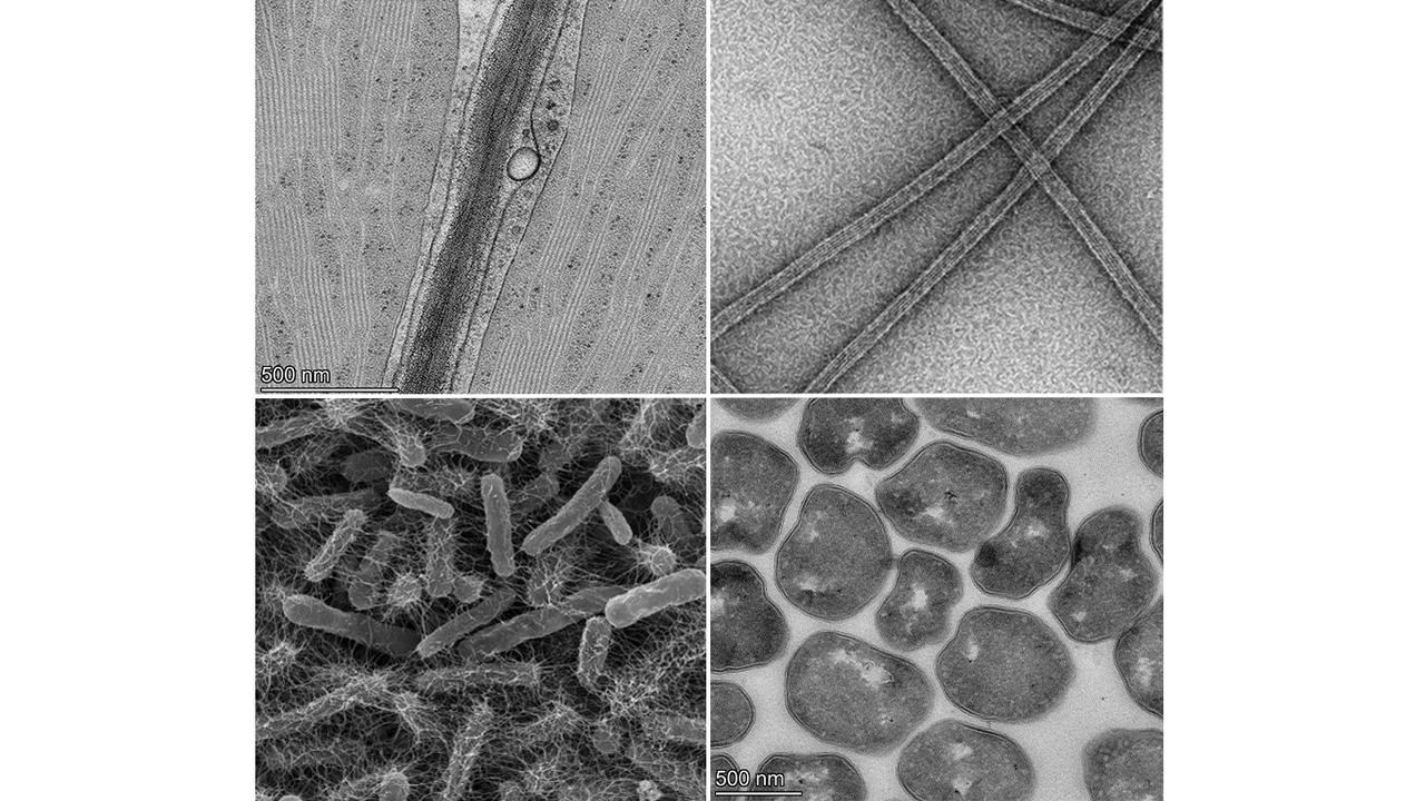 A series of electron microscopy images