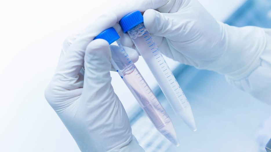 Gå till sida Proteinet som hjälper cancerceller att överleva behandling