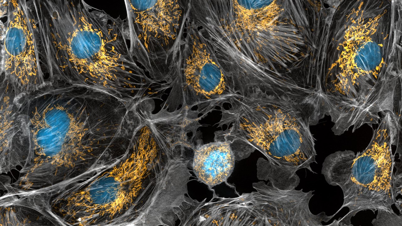 Foto genom mikroskop på celler.