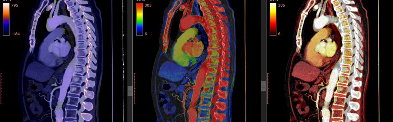 Datortomografi av thorax och buk.