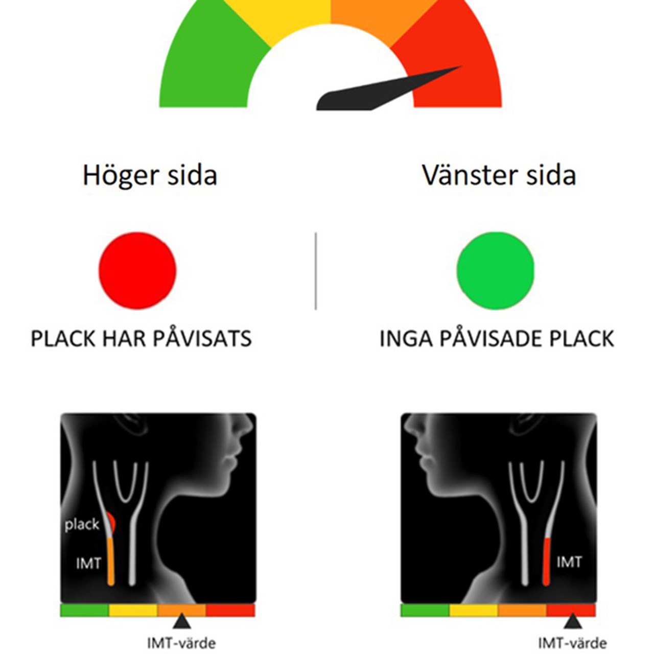 Illustration av ultraljudsresultat inom VIPVIZA-studien