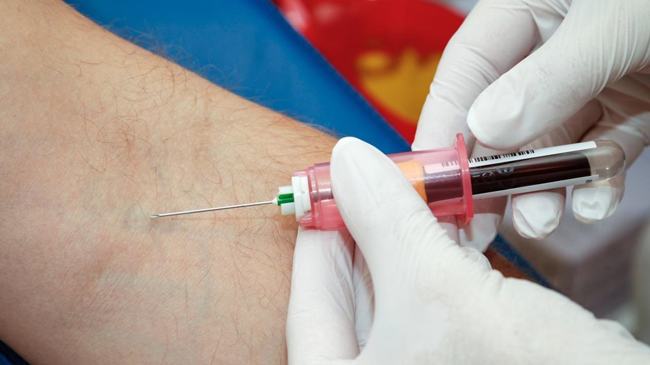 Gå till sida Ärftlig cancertestning kopplad till övergående oro