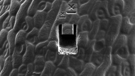 Transmission electron microscopy image of a biological samples