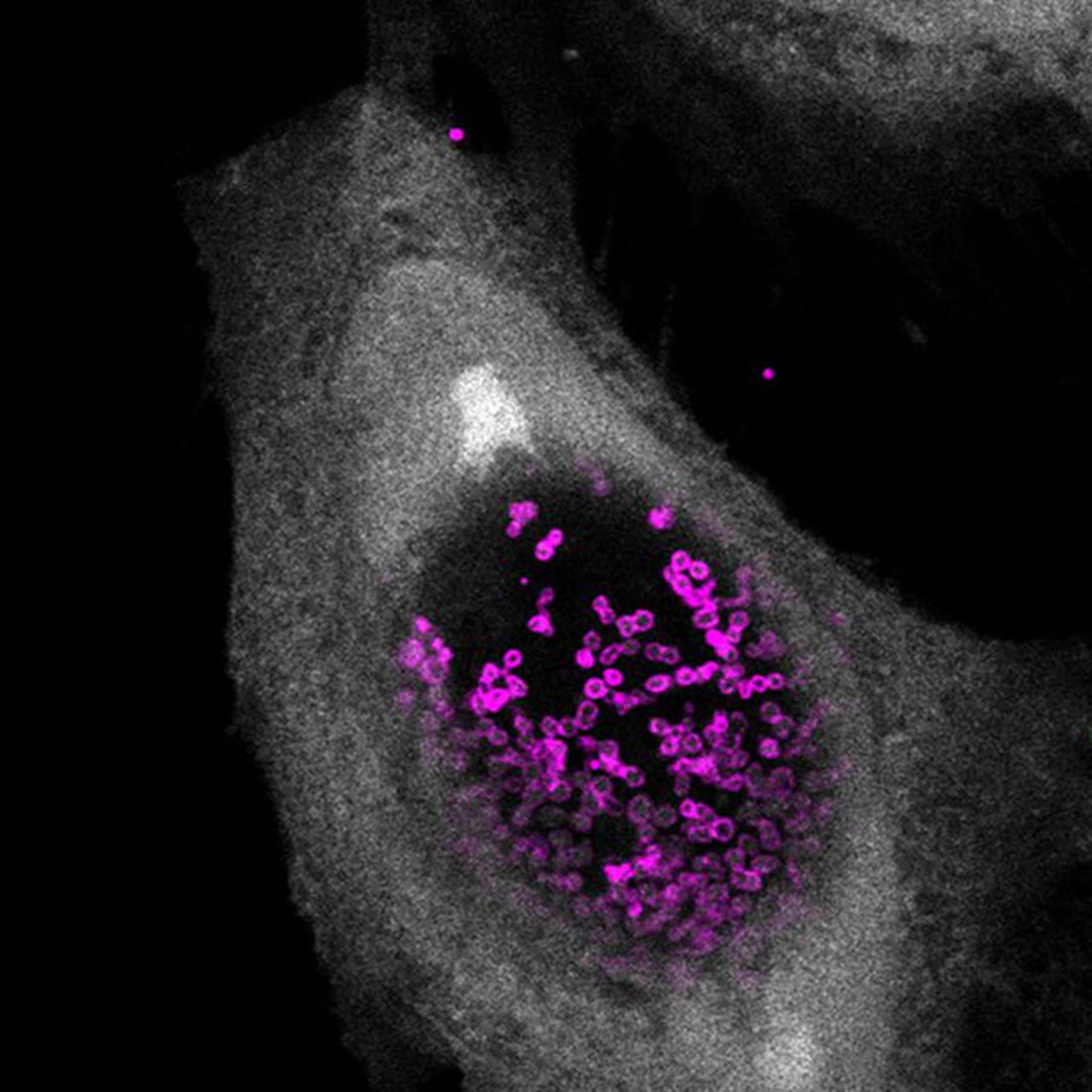 Caption: Confocal fluorescence microscopic image displaying a human cell (gray) infected with Chlamydia trachomatis (magenta).