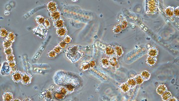 Spring bloom of phytoplankton through a microscope.