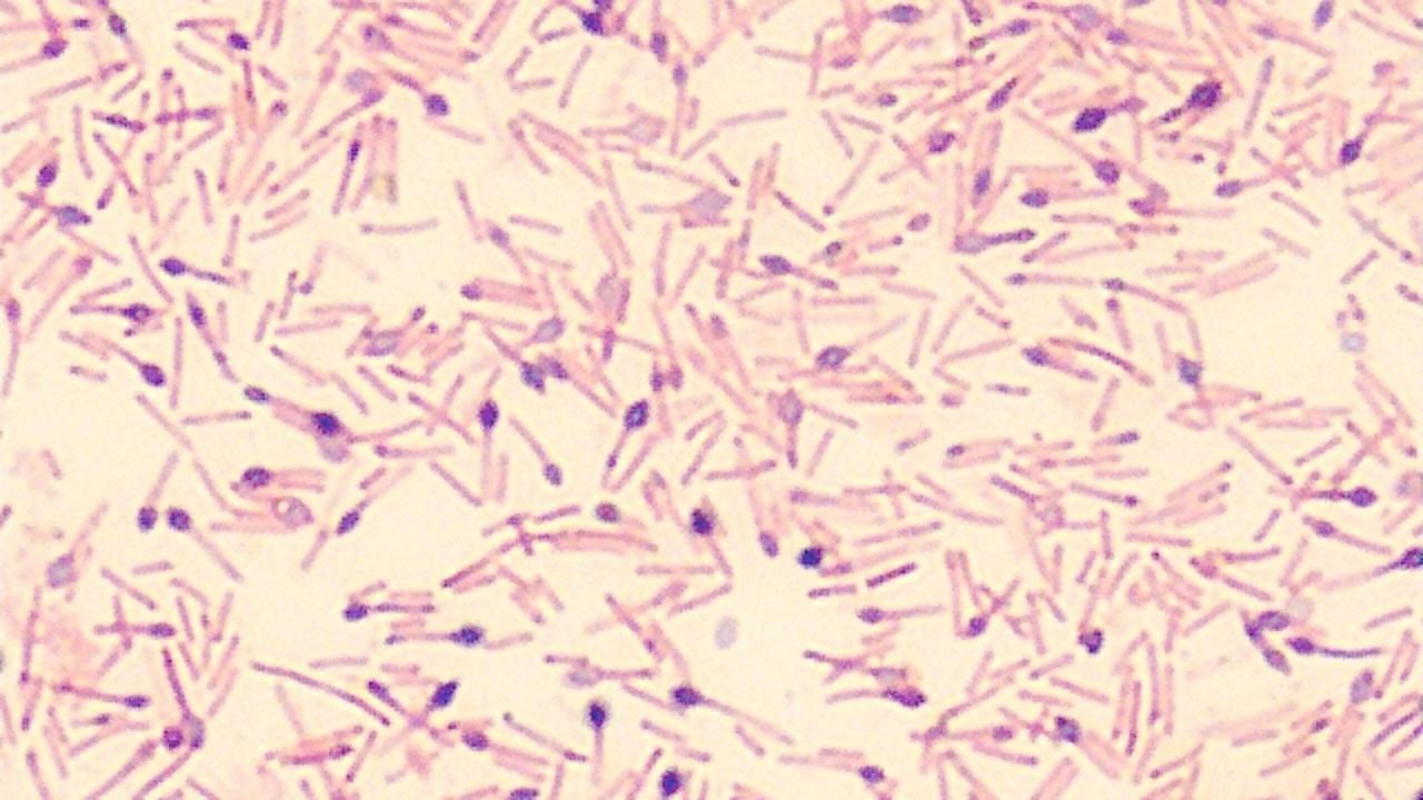 sporbildande bakterie