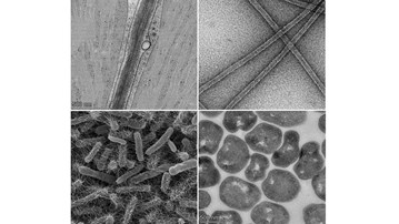 A series of electron microscopy images