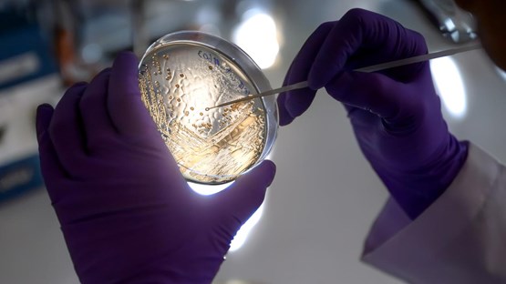 A person in purple gloves holding a petri dish.