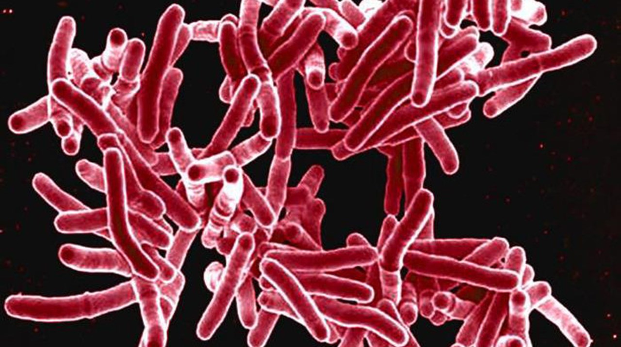 Tuberkulosbakterie