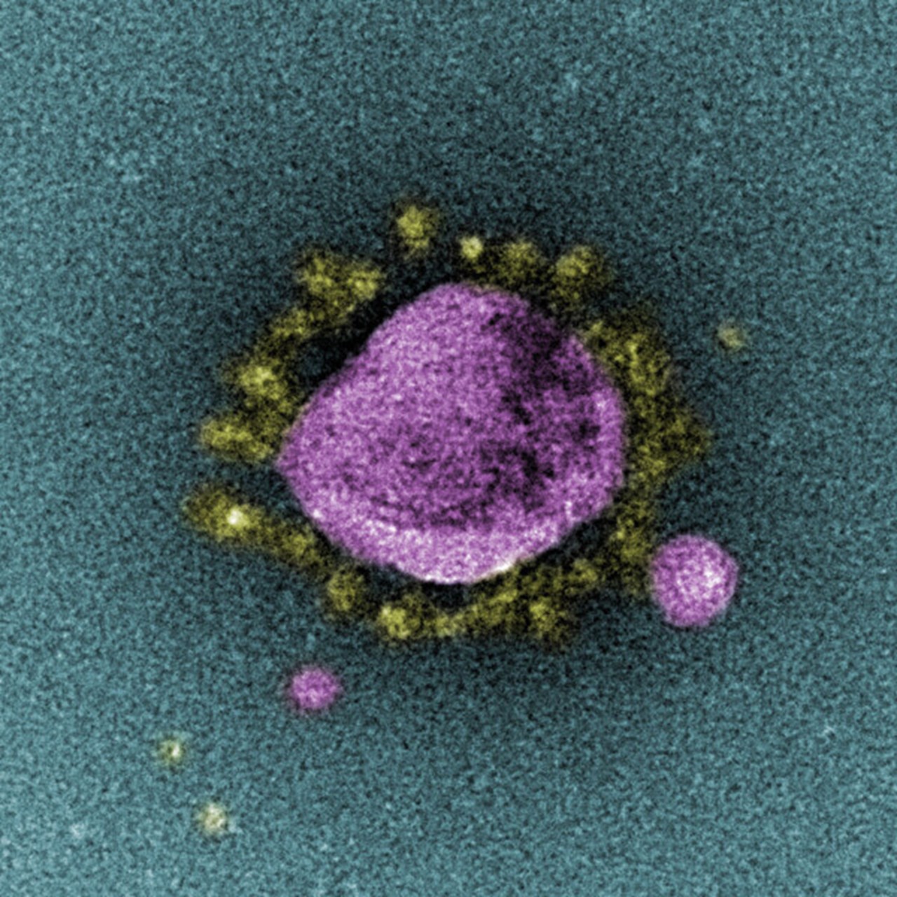 Bild på corona-virus tagna i mikroskop.