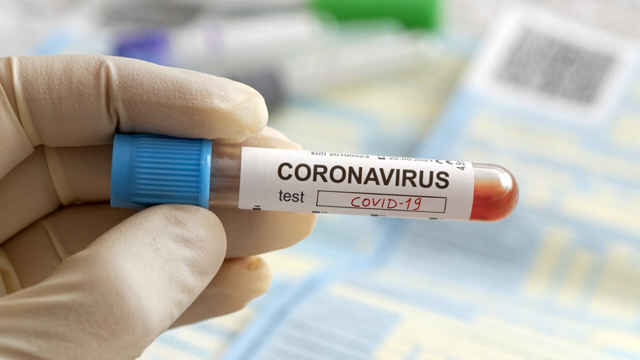 Sjuksköterskas hand som håller ett blodprov som test för coronavirus.