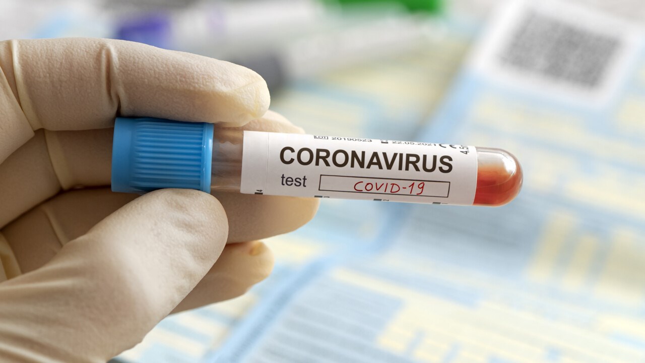 Sjuksköterskas hand som håller ett blodprov som test för coronavirus.