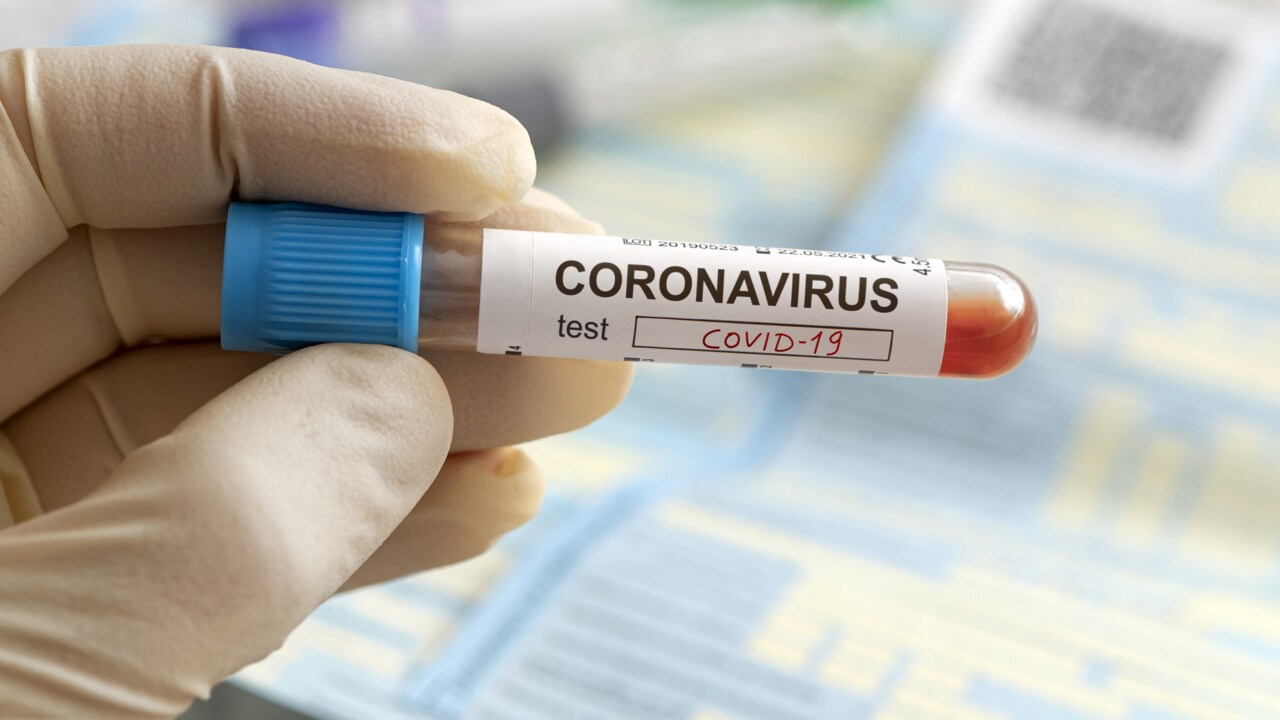 Sjuksköterskas hand som håller ett blodprov som test för coronavirus.