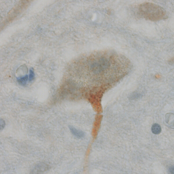 Bild på helveckad protein i nervcell