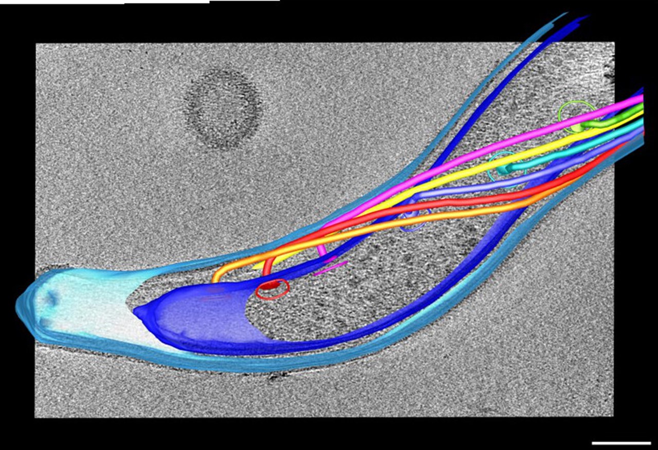 Kryo-electrontomogram av en Borrelia-bakterie.