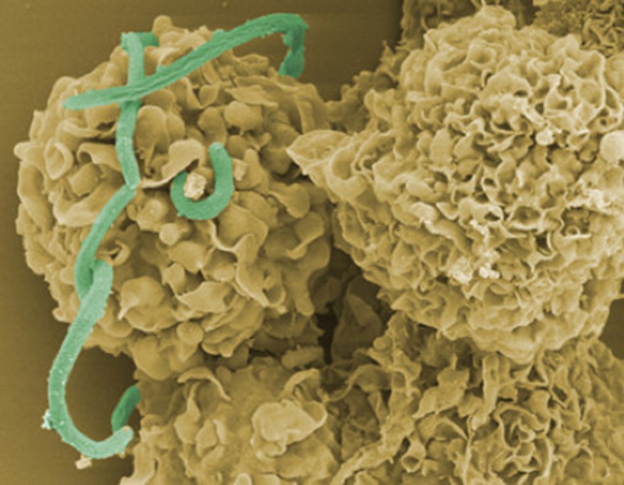 Photo on electron micrograph depicting bacteria in contact with immune cells