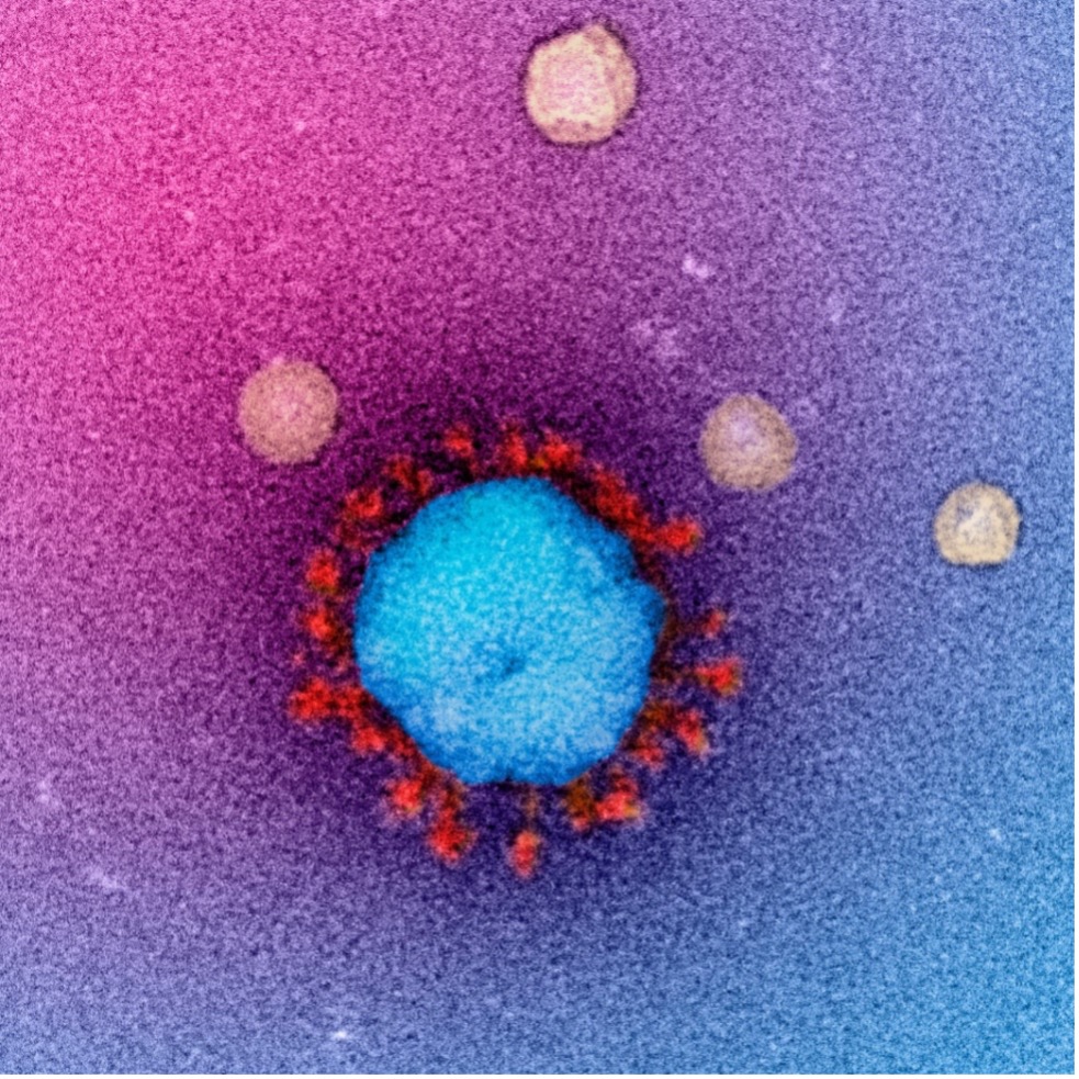 Transmission electron microscope image of SARS-CoV-2 virus particle