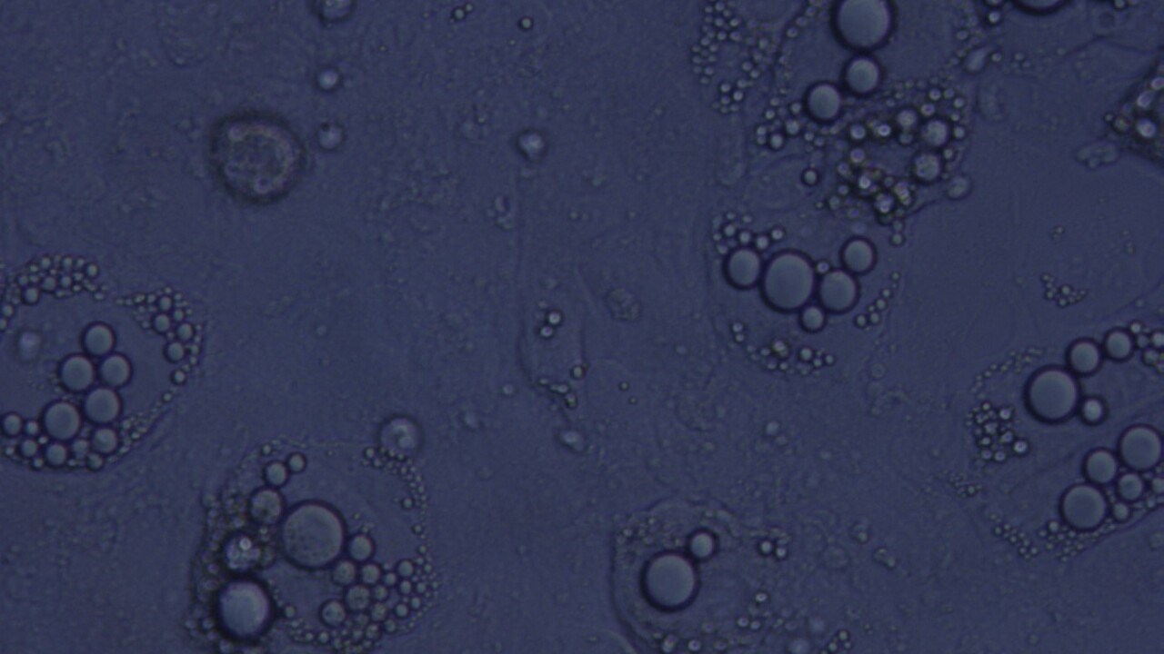 Mikroskopbild på samlingar med blåa ringar
