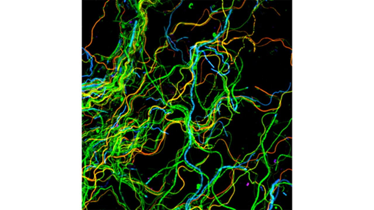 Fluorescence In Situ Hybridization (FISH) - Advanced Technologies for Single Cell Visualization and Identification Fluorescence In Situ Hybridization (FISH) - Advanced Technologies for Single Cell Visualization and Identification