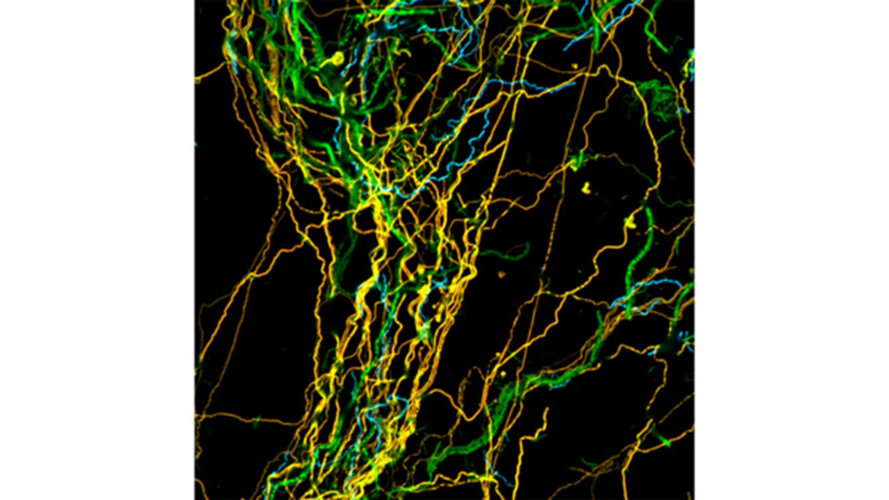 Fluorescence In Situ Hybridization (FISH) - Advanced Technologies for Single Cell Visualization and Identification Fluorescence In Situ Hybridization (FISH) - Advanced Technologies for Single Cell Visualization and Identification
