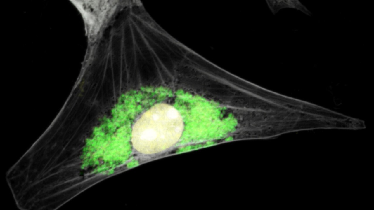 Guinea pig cell infected with Chlamydia caviae - marsvin cell smittad med klamydia