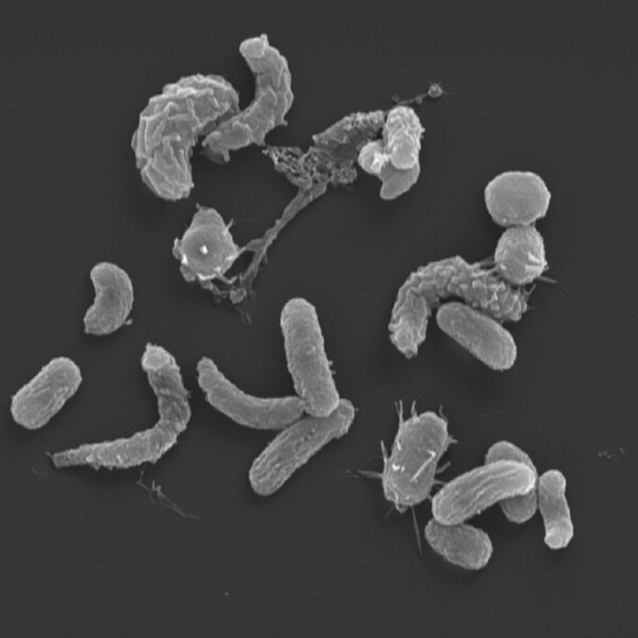 bakterier i extremförstoring som ser ut som böjda och raka korvar med utskott