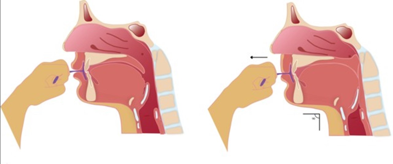 Illustration munskärm