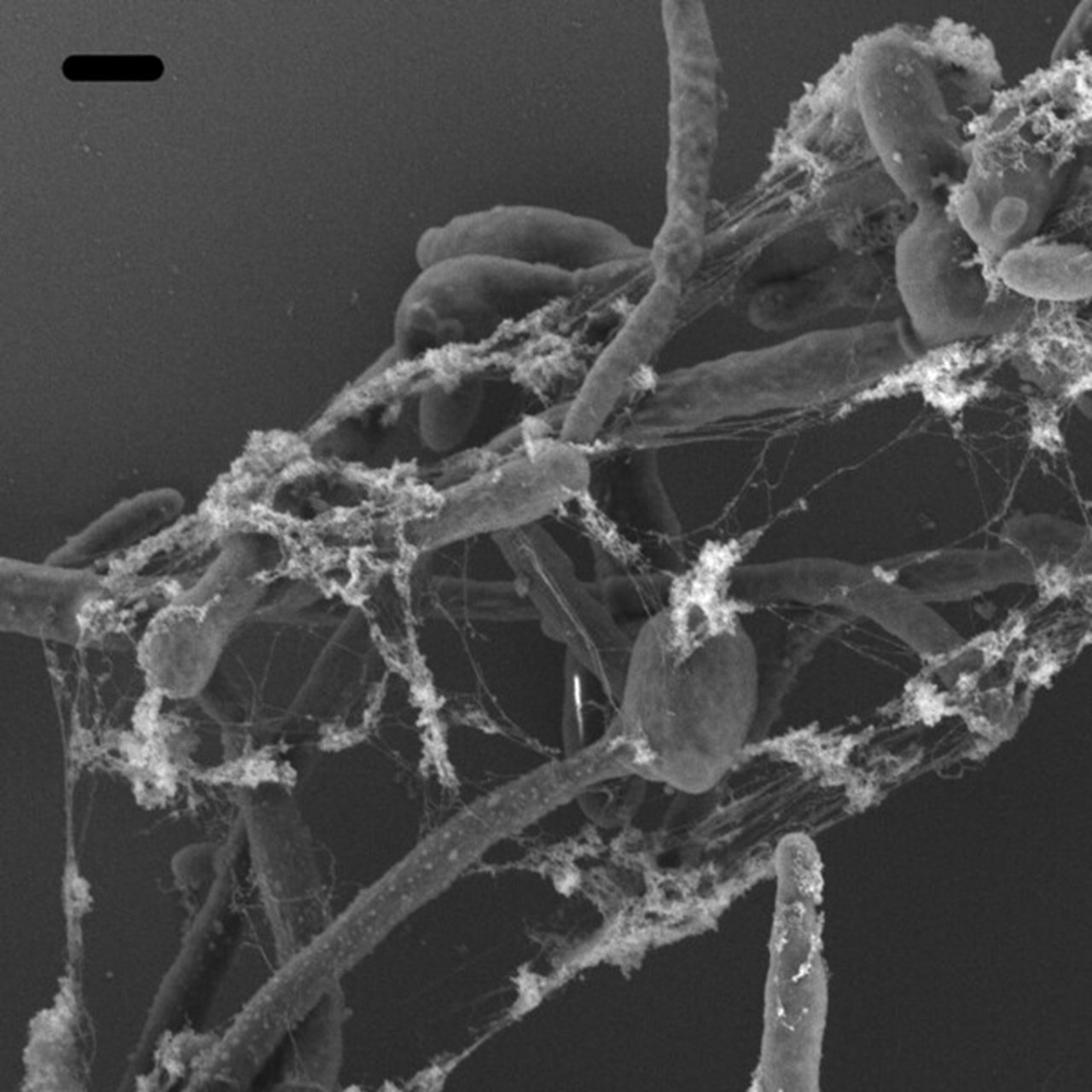 NETS och Candida albicans hyfer