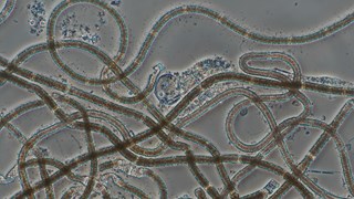 alger i ett mikroskop