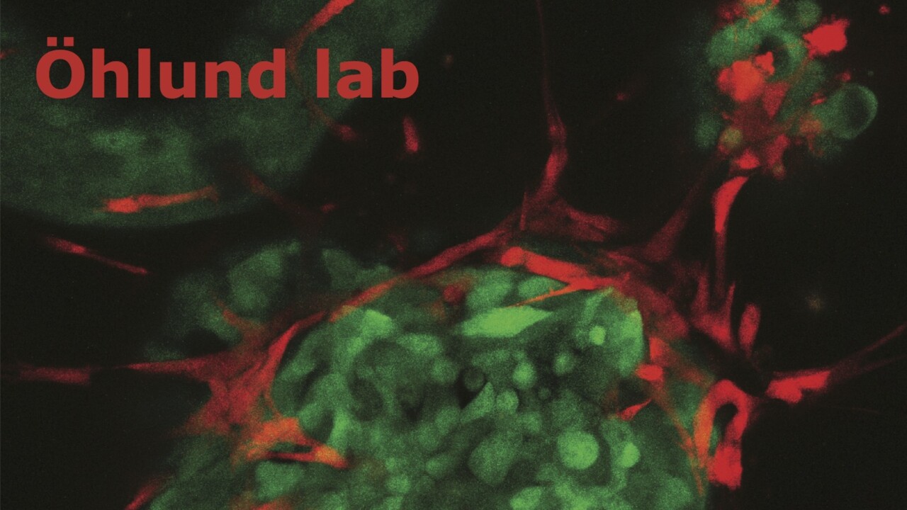 A picture of Cell culture of stromal cells, in red, and cancer cells, in green. In these co-cultures the interactions between cancer cells and stromal cells can be studied