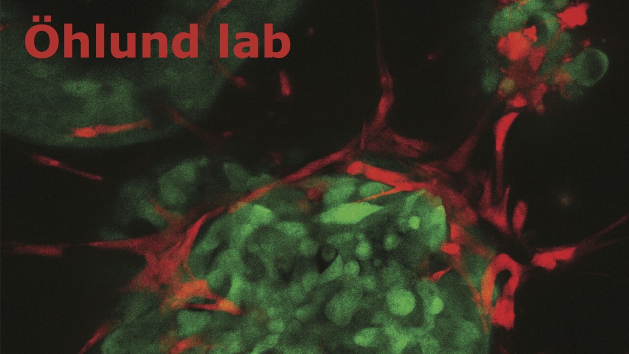 A picture of Cell culture of stromal cells, in red, and cancer cells, in green. In these co-cultures the interactions between cancer cells and stromal cells can be studied