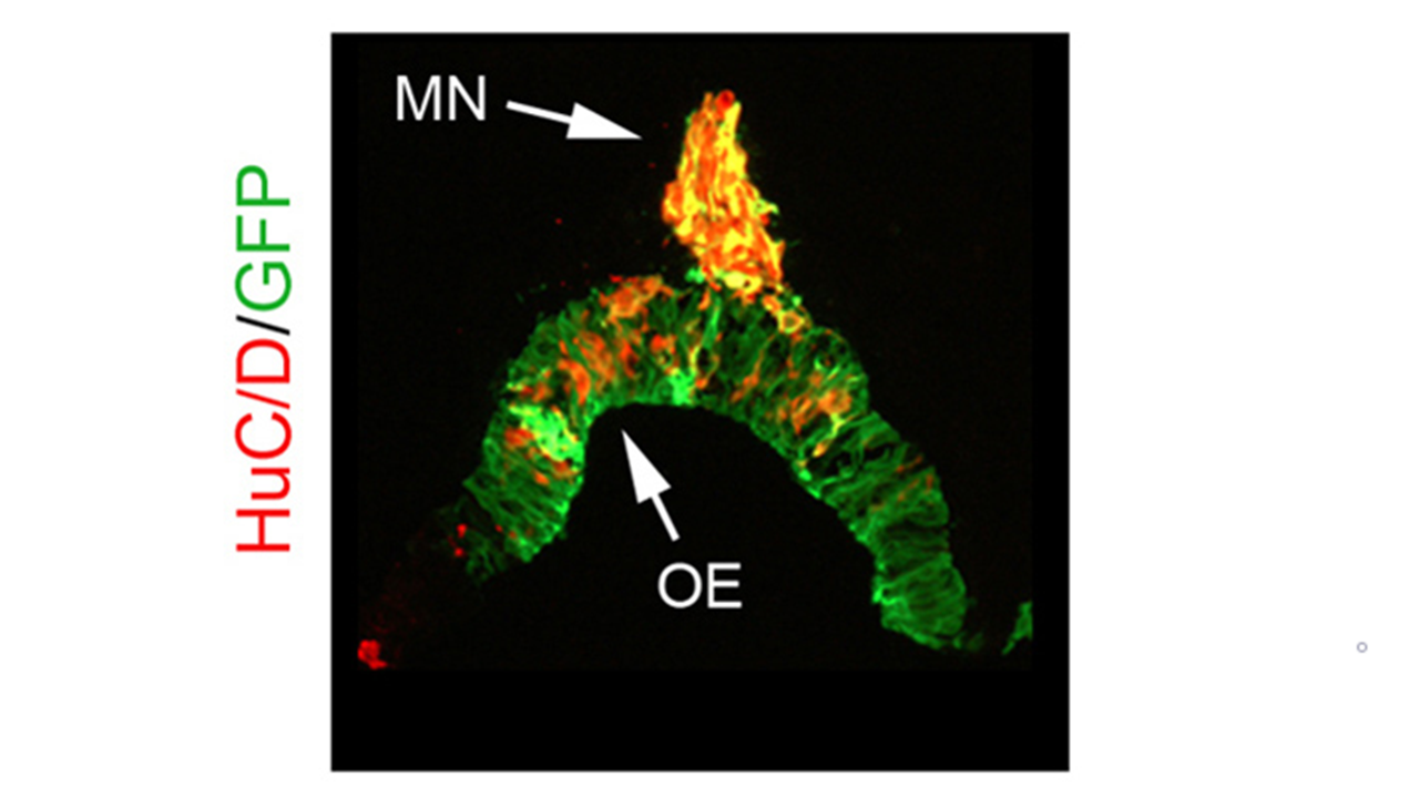 GFP-electroporated olfactory epithelium (OE).