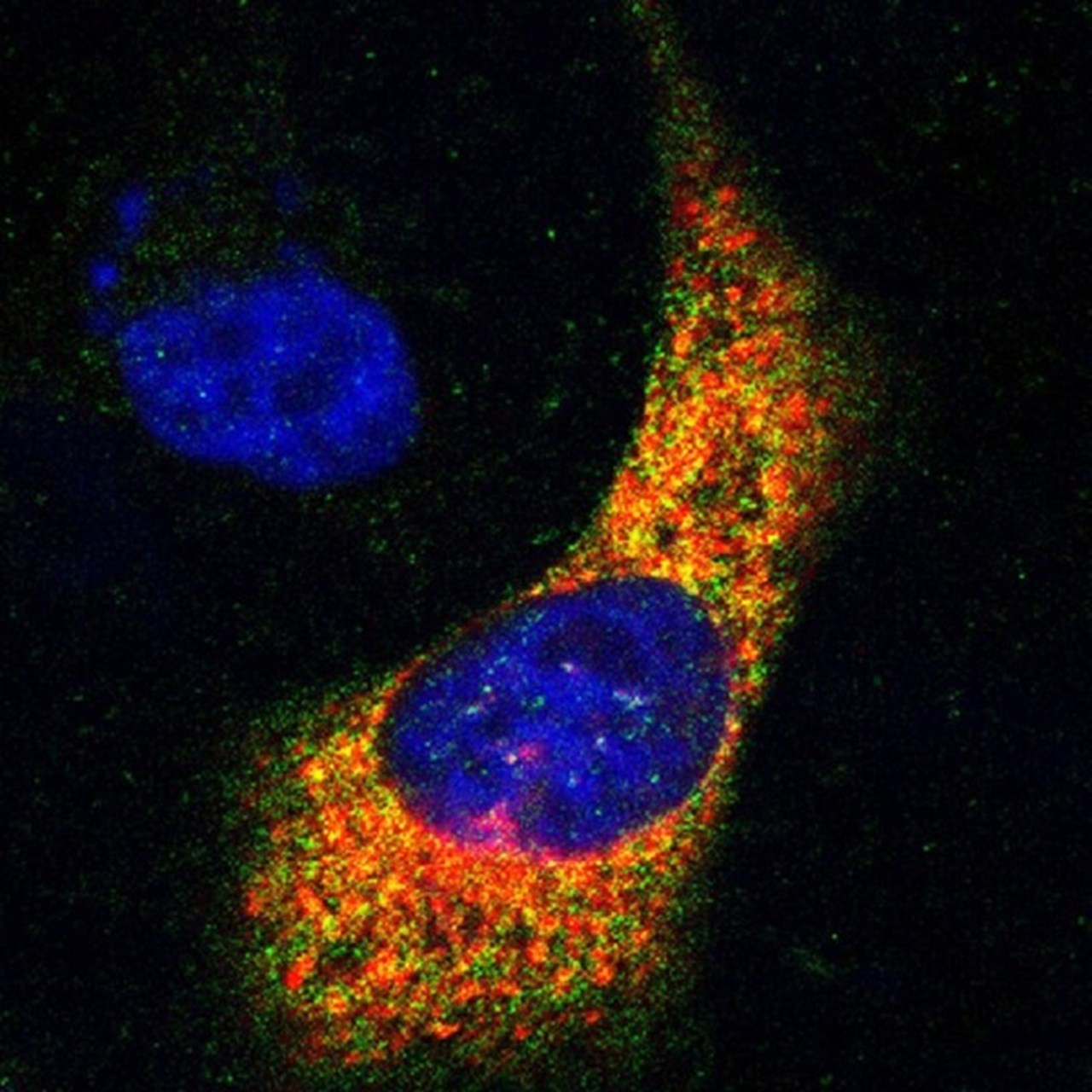 Mikroskopbild på proteiner i prostatacancercell