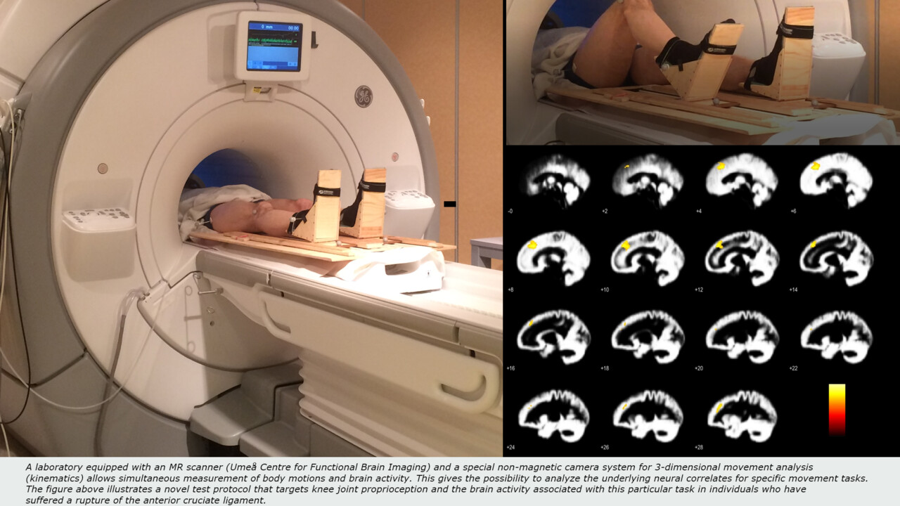 fMRI