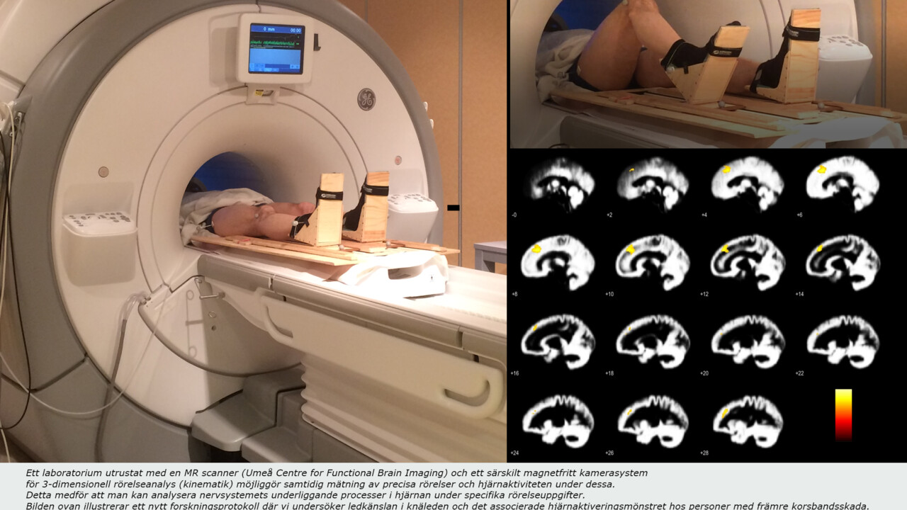 fMRI