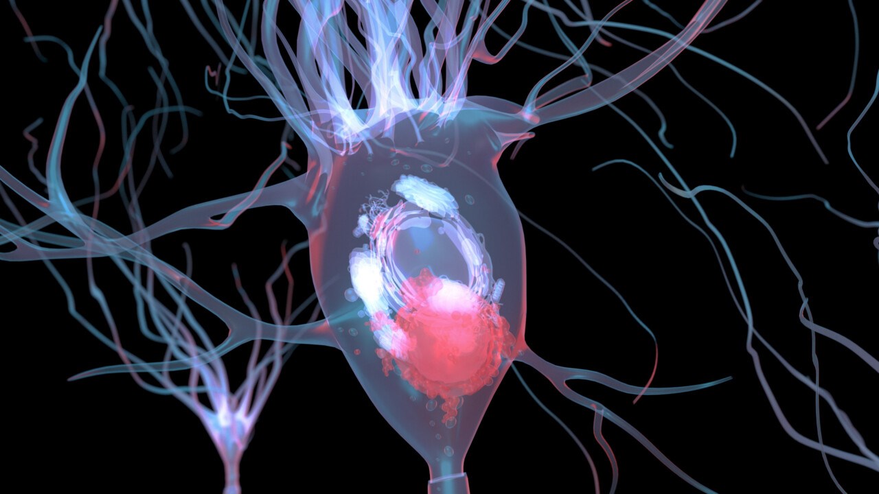 Illustrationen visar proteinaggregat i en nervcells cytoplasma