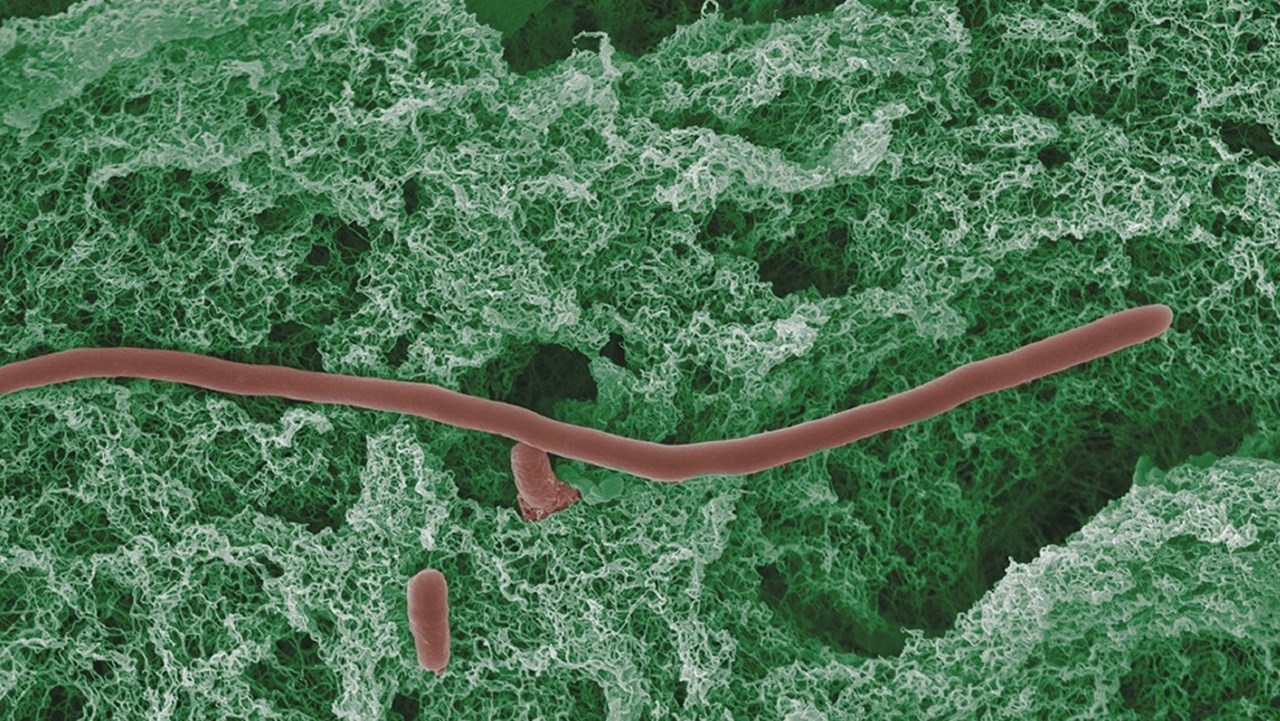 Streptomycesbakterie omgiven av FilP fibrer