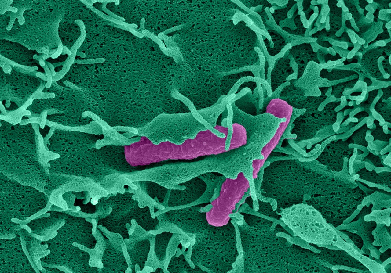 Coloured electron microscopy image of a nascent plasma membrane ruffle enclosing a bacterium which invades an intestinal epithelial cell. Sample: Lalitha Tadala; Image acquisition: Ramón Cervantes-Rivera; Artistic rendering: Atin Sharma. MIMS, Umeå University.