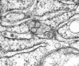 Transmission electron microscope image of a cell infected with the TBE virus