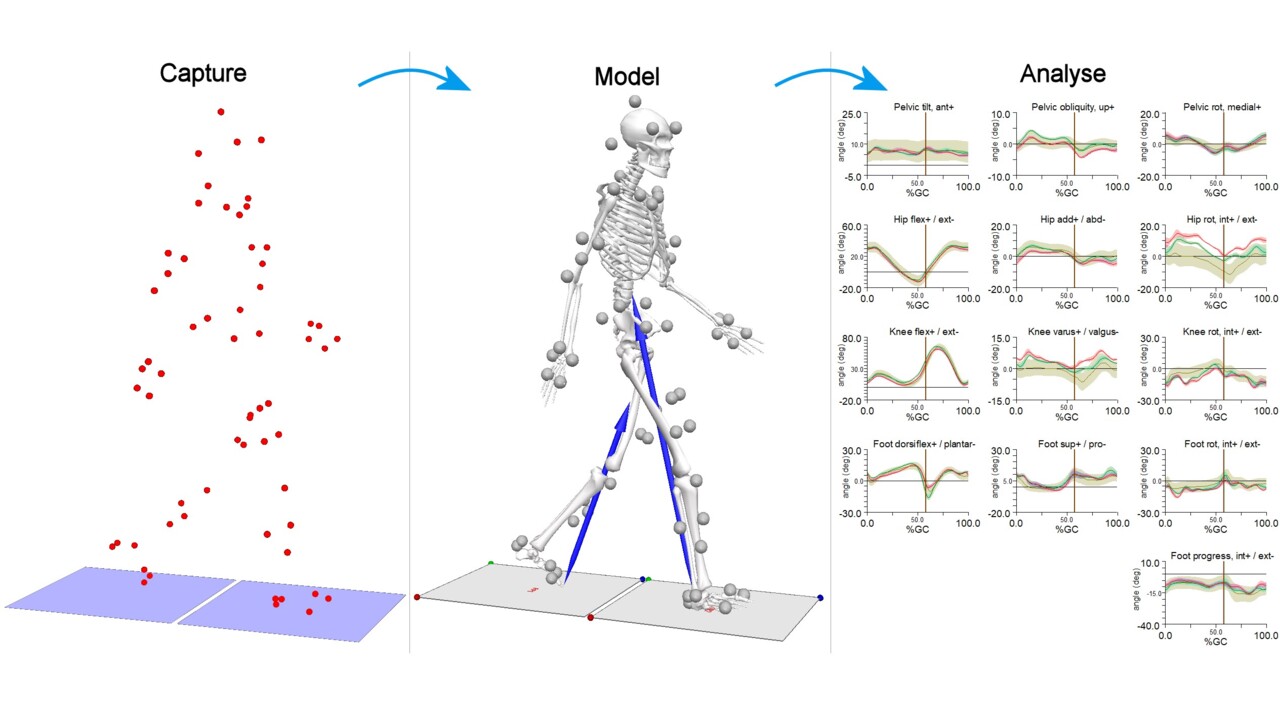 U-Motion Laboratory Gait Analysis