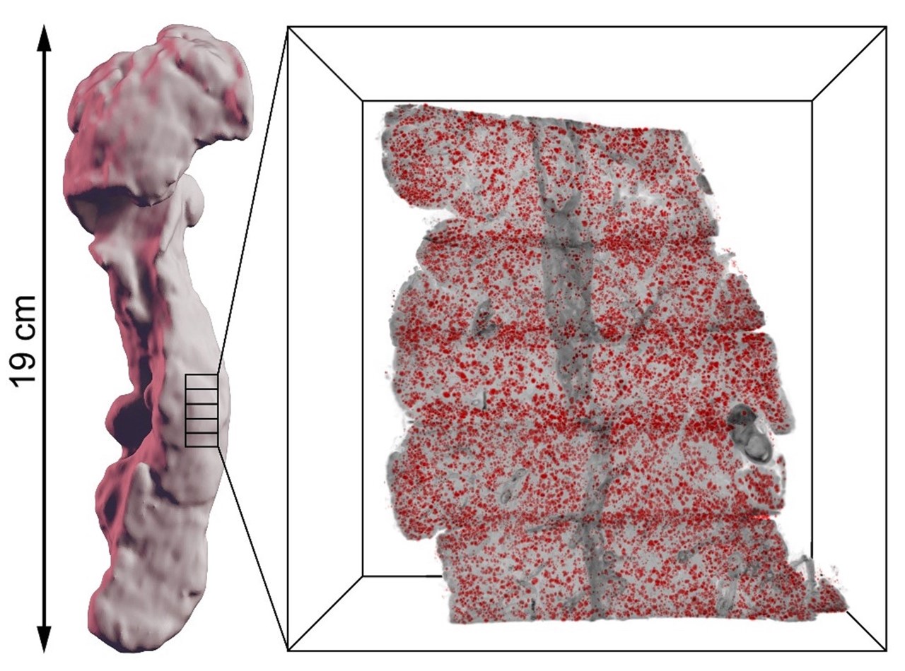 Insulin producing islets of Langerhans in the human pancreas (red), visualized by OPT