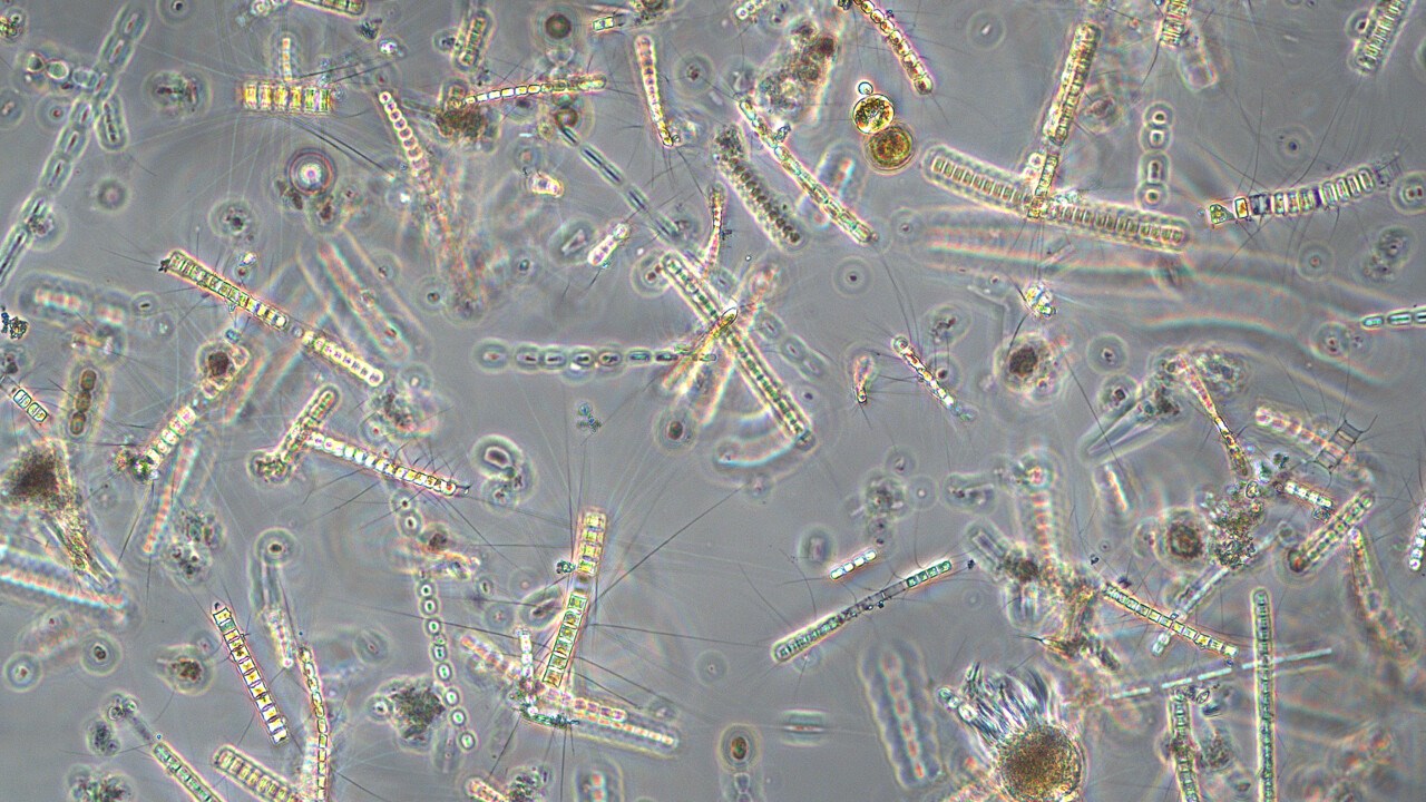 Mikroskopbild på växtplankton