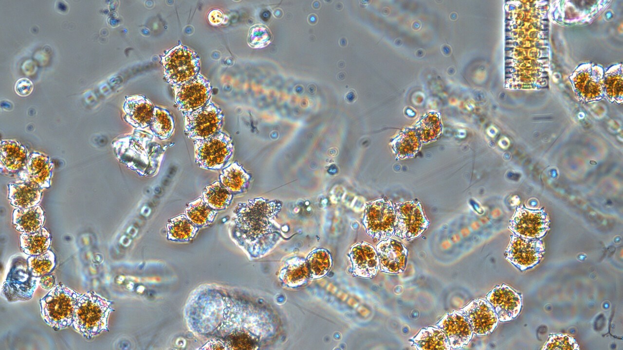 Mikroskopbild på växtplankton