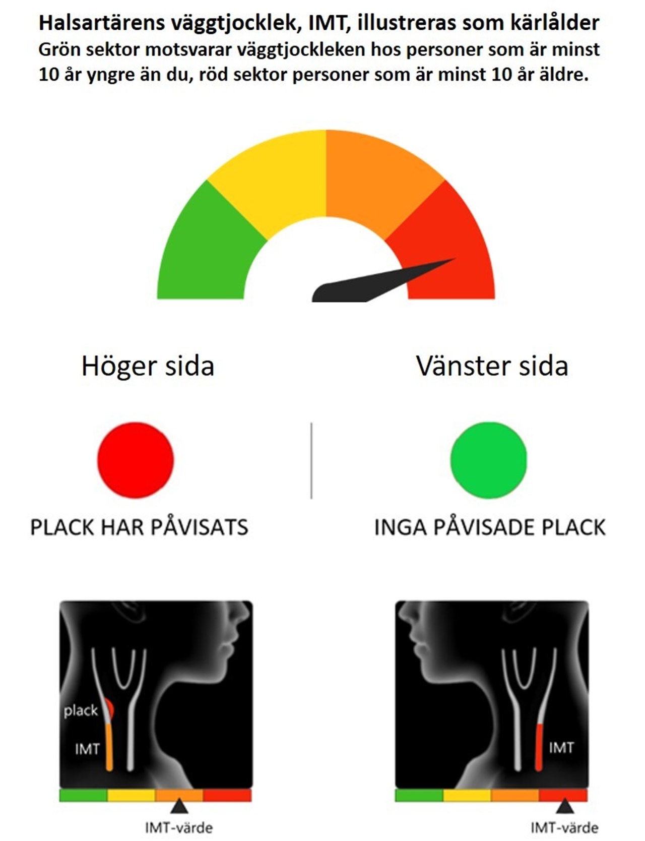 Illustration av ultraljudsresultat inom VIPVIZA-studien
