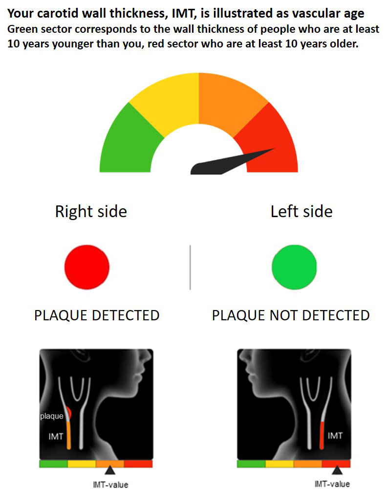 VIPVIZA ultrasound result image