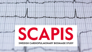 Frekvenskurva ekg med SCAPIS logotyp i förgrunden.