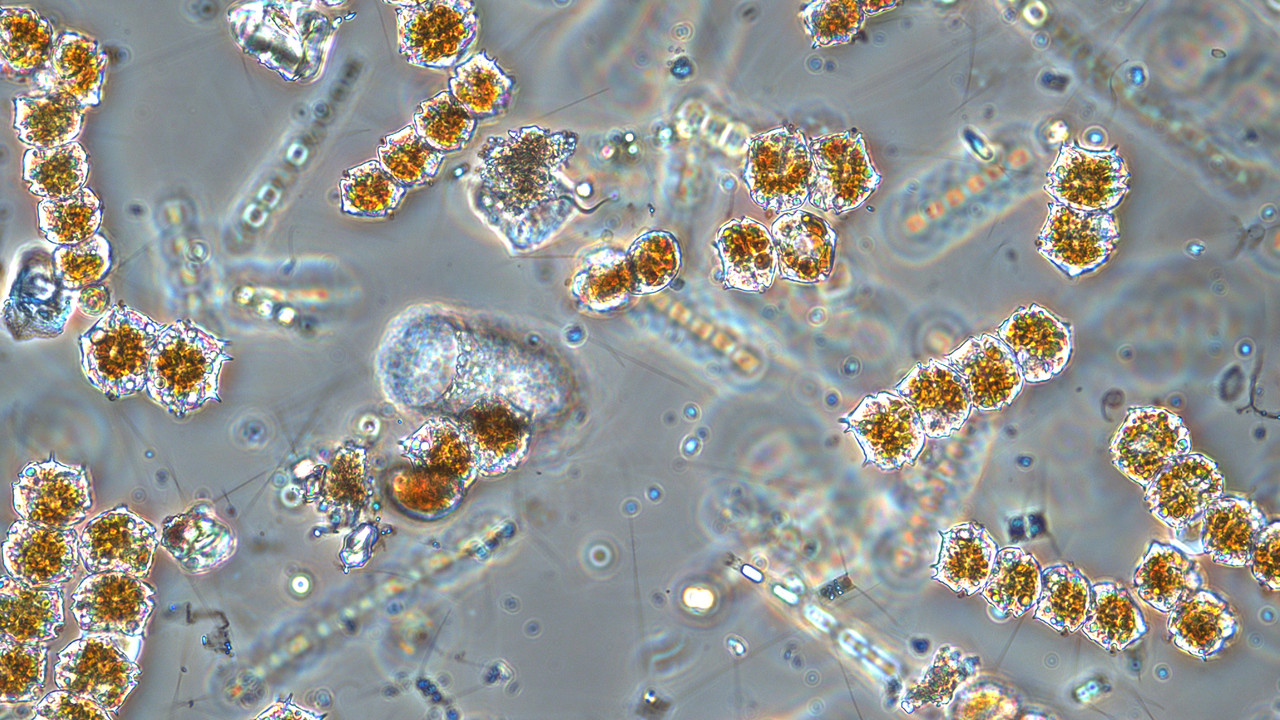 Mikroskopbild på växtplankton från Bottniska viken.